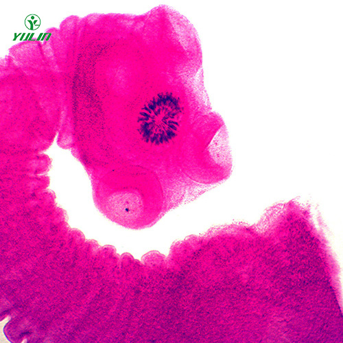 江苏医学蠕虫绦虫装片